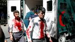 Viele Tote durch Explosion in Kabul