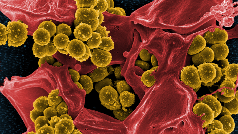 Multiresistente Erreger: Ein digital nachbearbeitetes Bild einiger multiresistenter Bakterien, Staphylokokken (gelb), aus einem elektronenmikroskopischen Scan