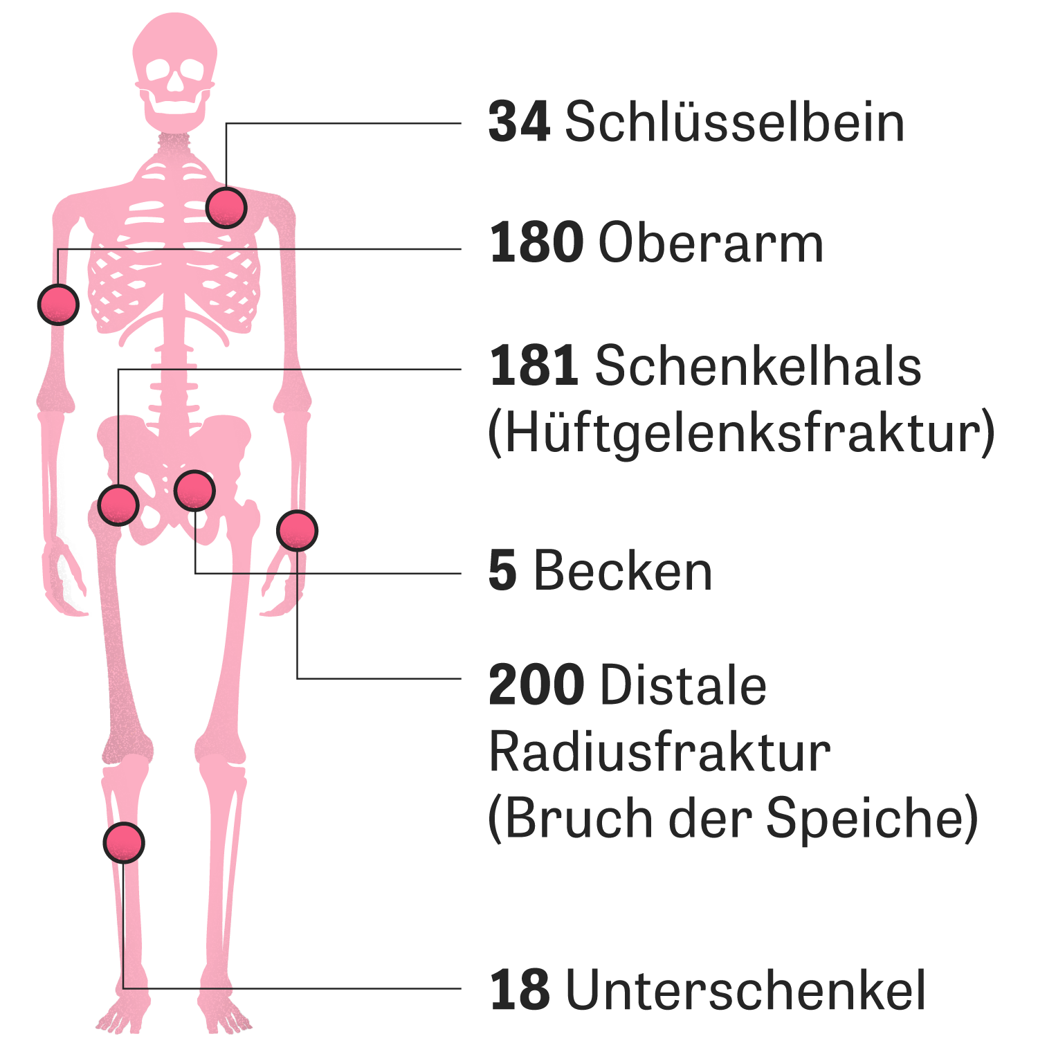 Knochen Was uns im zusammenhält ZEIT ONLINE