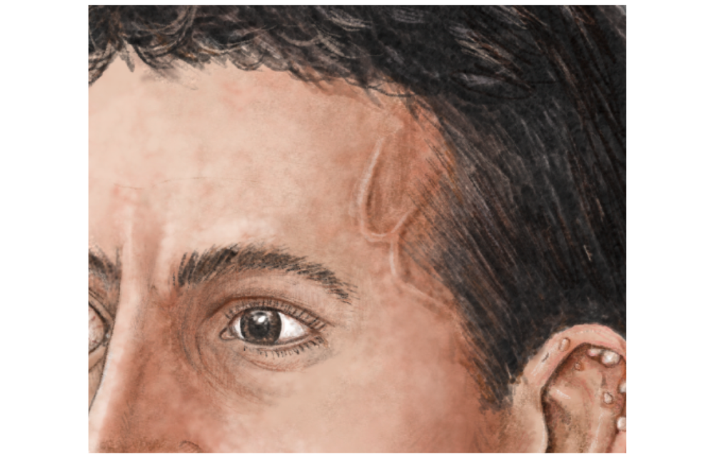 Krankheitssymptome Auf den ersten Blick ZEIT ONLINE