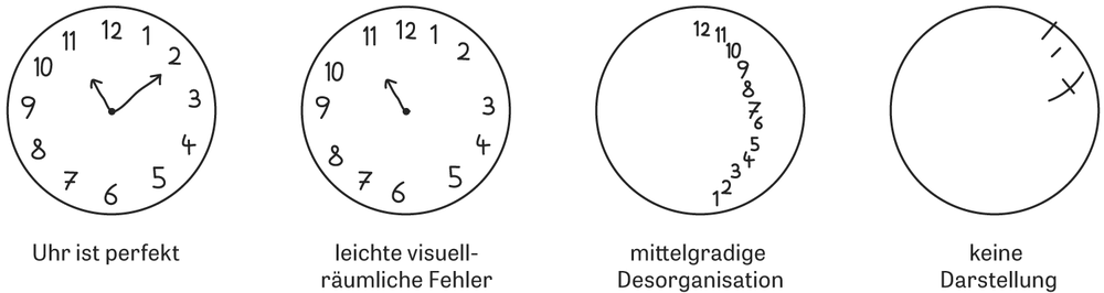 Fabelhafte Demenz Test Uhr Bilder
