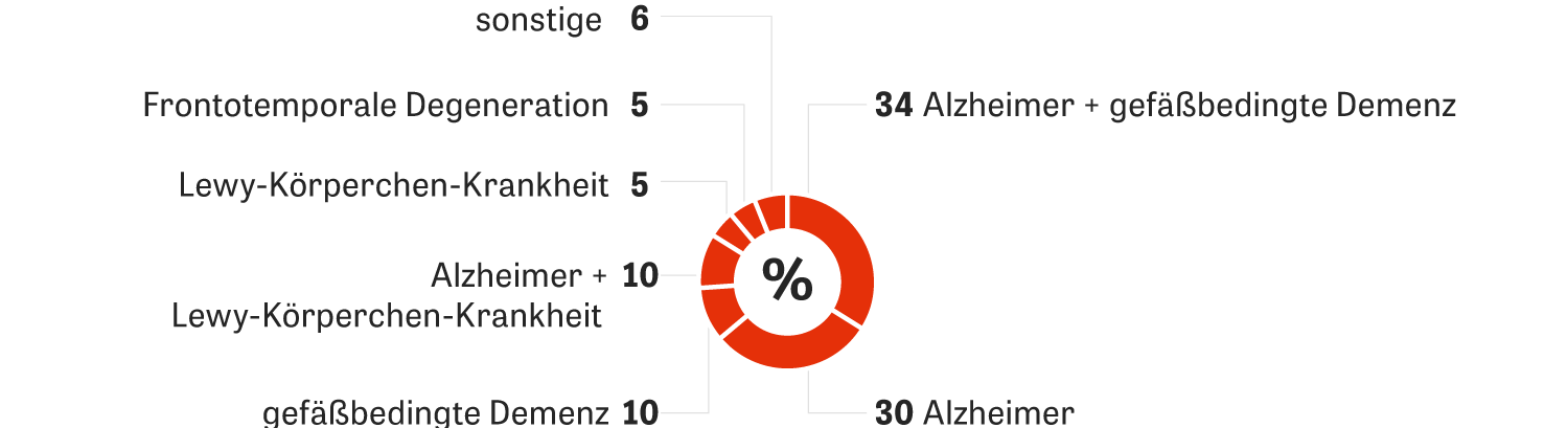 Demenztest Erkenne Den Elefanten Zeit Online