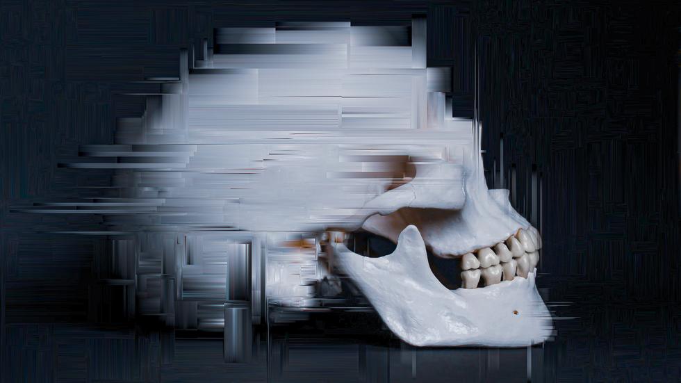 Zähneknirschen Mein Kiefer, ein Schraubstock ZEIT