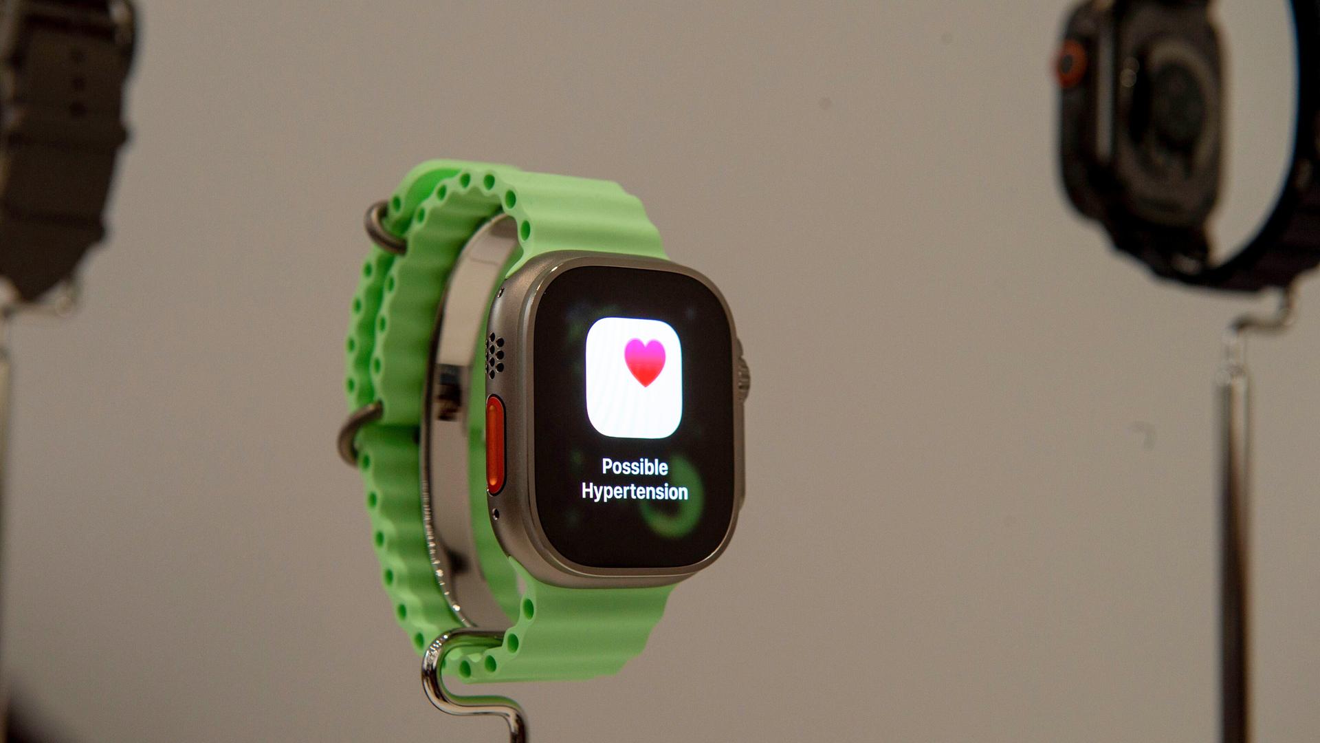 Apple Watch: Der Arzt am Handgelenk