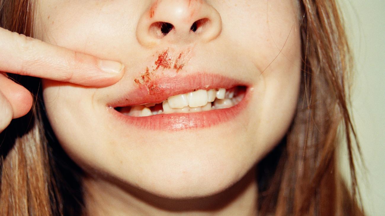 Terminservice- und Versorgungsgesetz: Schneller Termin? Das kostet!