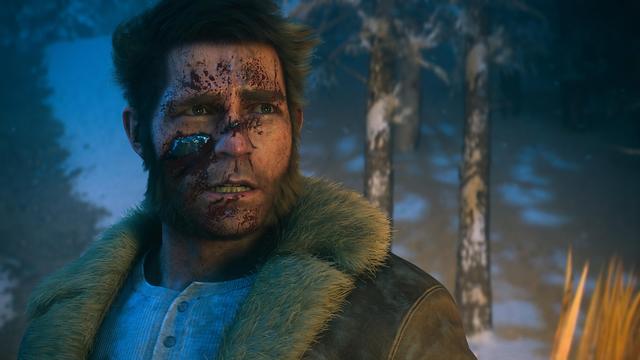 »Marvel’s Wolverine«: Von Albträumen geplagt? Töten Sie ein paar Gegner auf Wut-Stufe 3