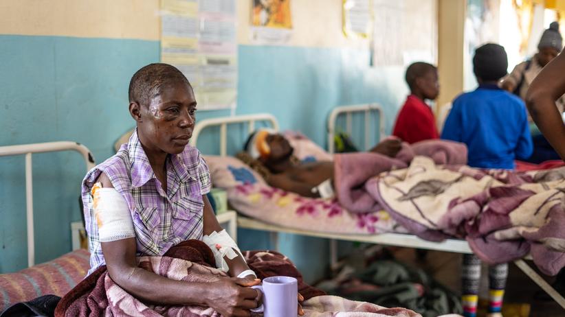 Zyklon Idai: Zykloneüberlebende in einem Krankenhaus im Osten Simbabwes