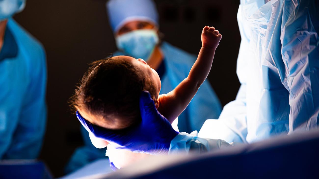 Geburtsmedizin: Jede dritte Geburt in deutschen Krankenhäusern per Kaiserschnitt