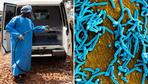 Marburgvirus: „Wir wissen, dass sich Ebola und Marburg sehr ähnlich verhalten“