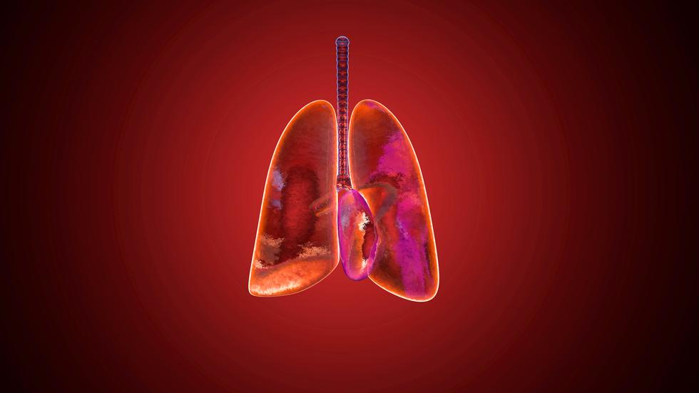 Feinstaub und Lungenkrebs Das Körnchen zum