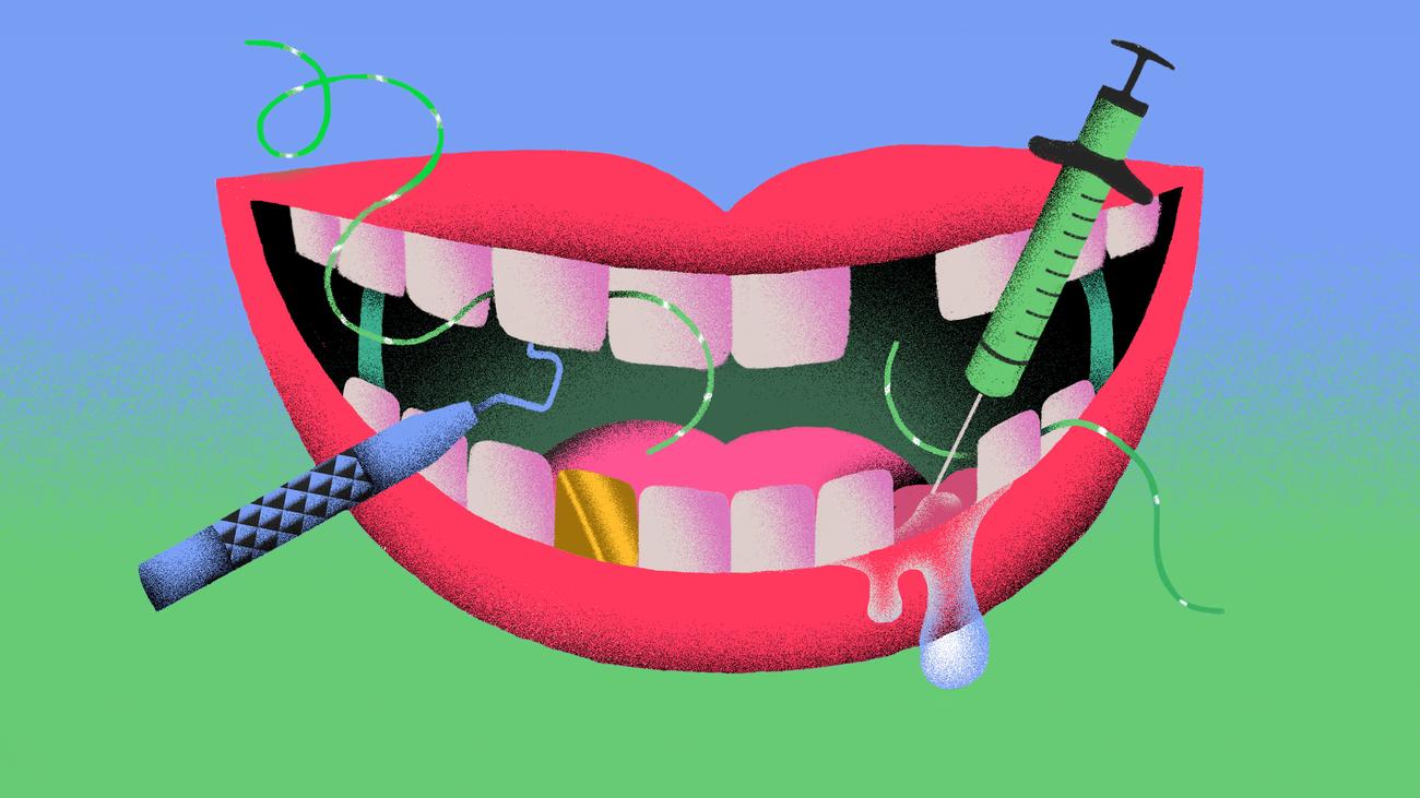 Santé dentaire : les mauvaises dents endommagent-elles notre cerveau ?