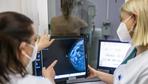 Schutz vor Brustkrebs: Mammografie-Screening laut Bundesbehörde schon ab 45 Jahren sinnvoll