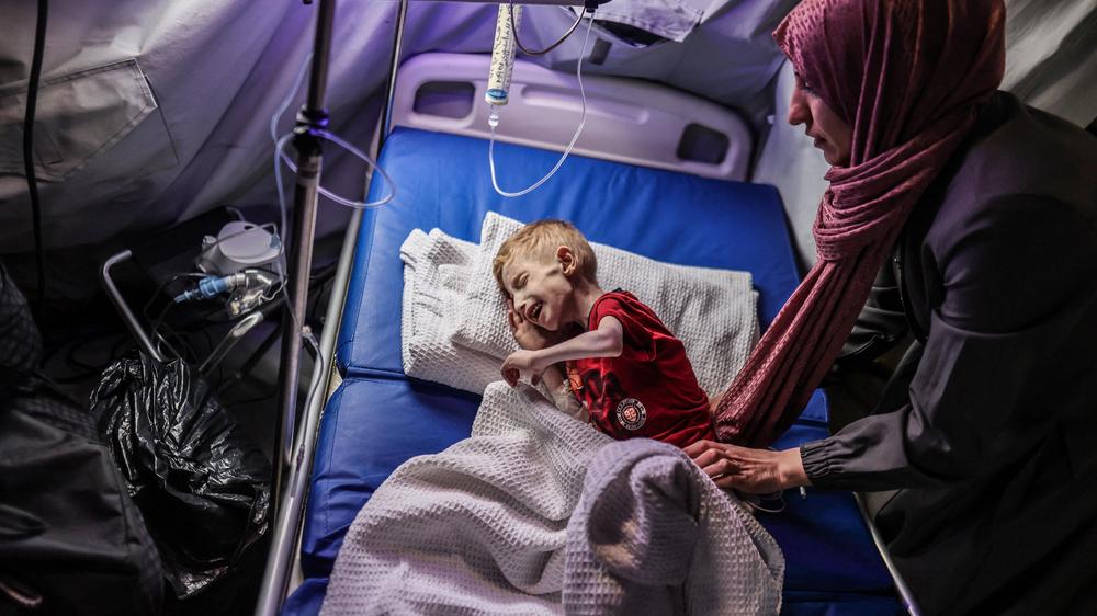 Hungersnot in Kriegen: Eine Klinik in Rafah im südlichen Gazastreifen: Der neunjährige Fadi wurde zur Behandlung aus dem Norden hierher gebracht, wo der Hunger die Menschen besonders hart trifft.