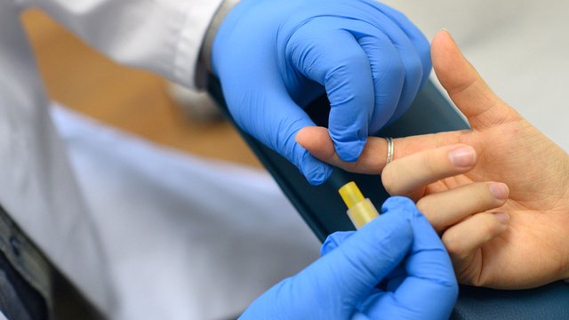 Robert Koch-Institut: 2.200 Menschen sollen sich 2023 in Deutschland mit HIV infiziert haben