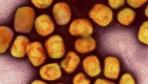 Infektionskrankheit: WHO besorgt über neue Mpox-Variante