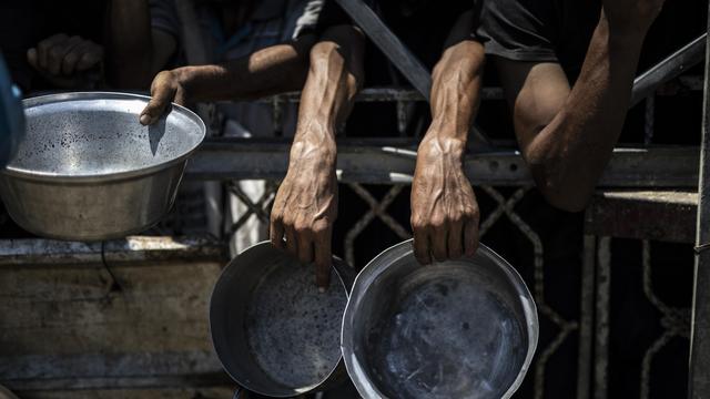 Gazastreifen: Kinder hungern, Ärzte werden im OP ohnmächtig