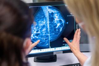 Krebserkennung: Medizinisches Personal untersucht mit einer Mammographie die Brust einer Frau auf Brustkrebs.(Zu dpa: «Etwas weniger Krebsneuerkrankungen 2022 in Thüringen»)