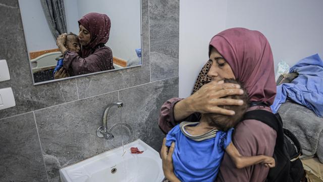 Hunger in Gaza: Das Kind aus Gaza, über das die Welt spricht