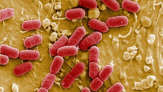 Robert Koch-Institut: Mindestens zwei Menschen in Deutschland an Ehec-Infektion gestorben