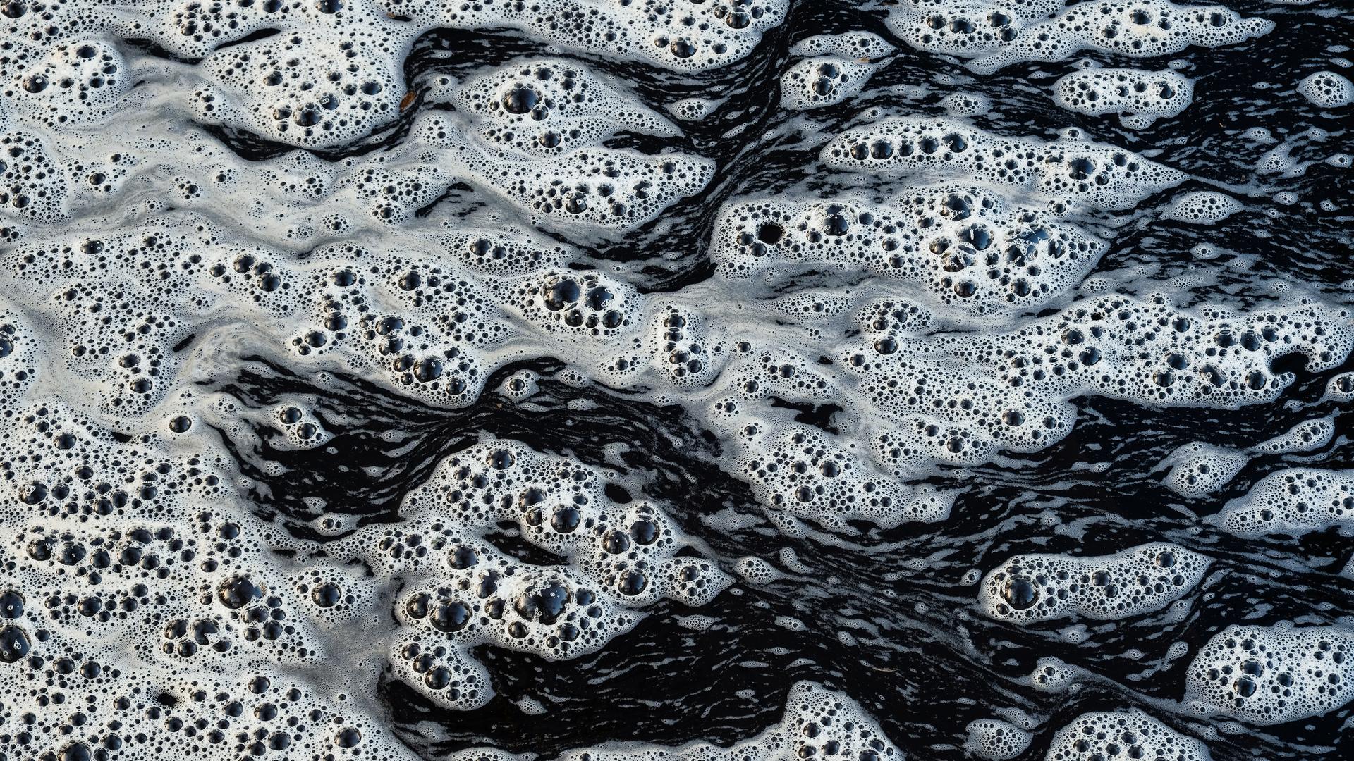 Kinderlähmung: Was der Poliovirus-Fund im Hamburger Abwasser bedeutet