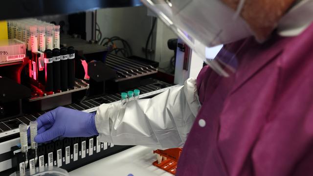 H5N5: USA melden ersten Toten durch seltenes Vogelgrippevirus