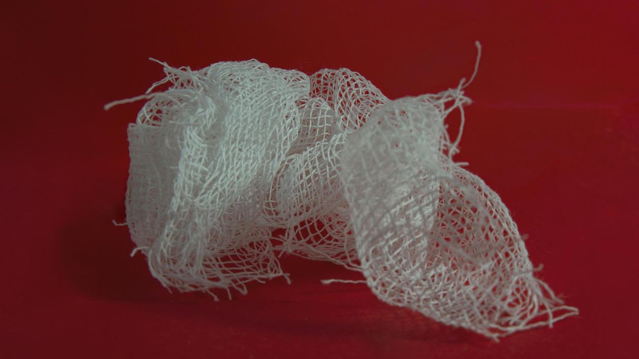 Brandverletzungen: "Die Überlebenschancen hängen auch vom Alter ab"