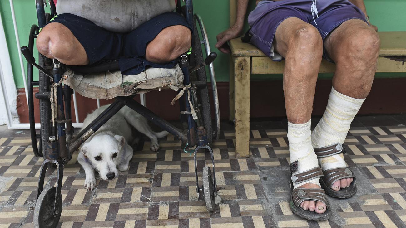 WHO: Chile hat als zweites Land überhaupt die Krankheit Lepra besiegt