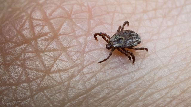 Borreliose und FSME: Zahl der Toten nach Zeckenbiss 2024 gestiegen