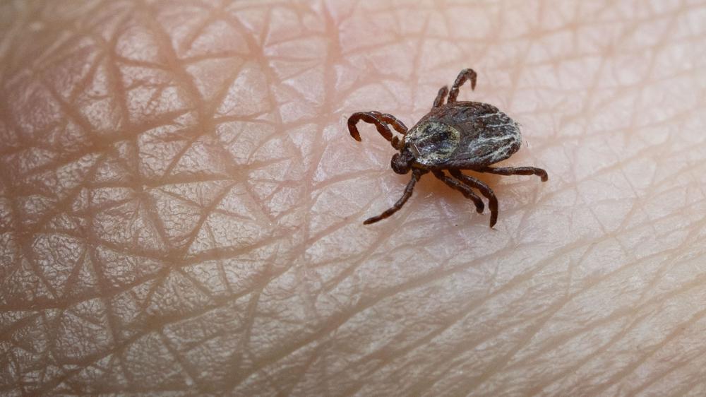 Borreliose und FSME: 24 Menschen starben in Deutschland 2024 an den Folgen eines Zeckenbisses.