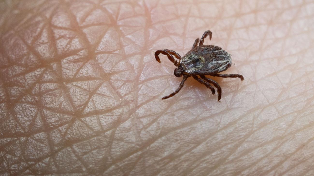 Borreliose und FSME: Zahl der Toten nach Zeckenbiss 2024 gestiegen