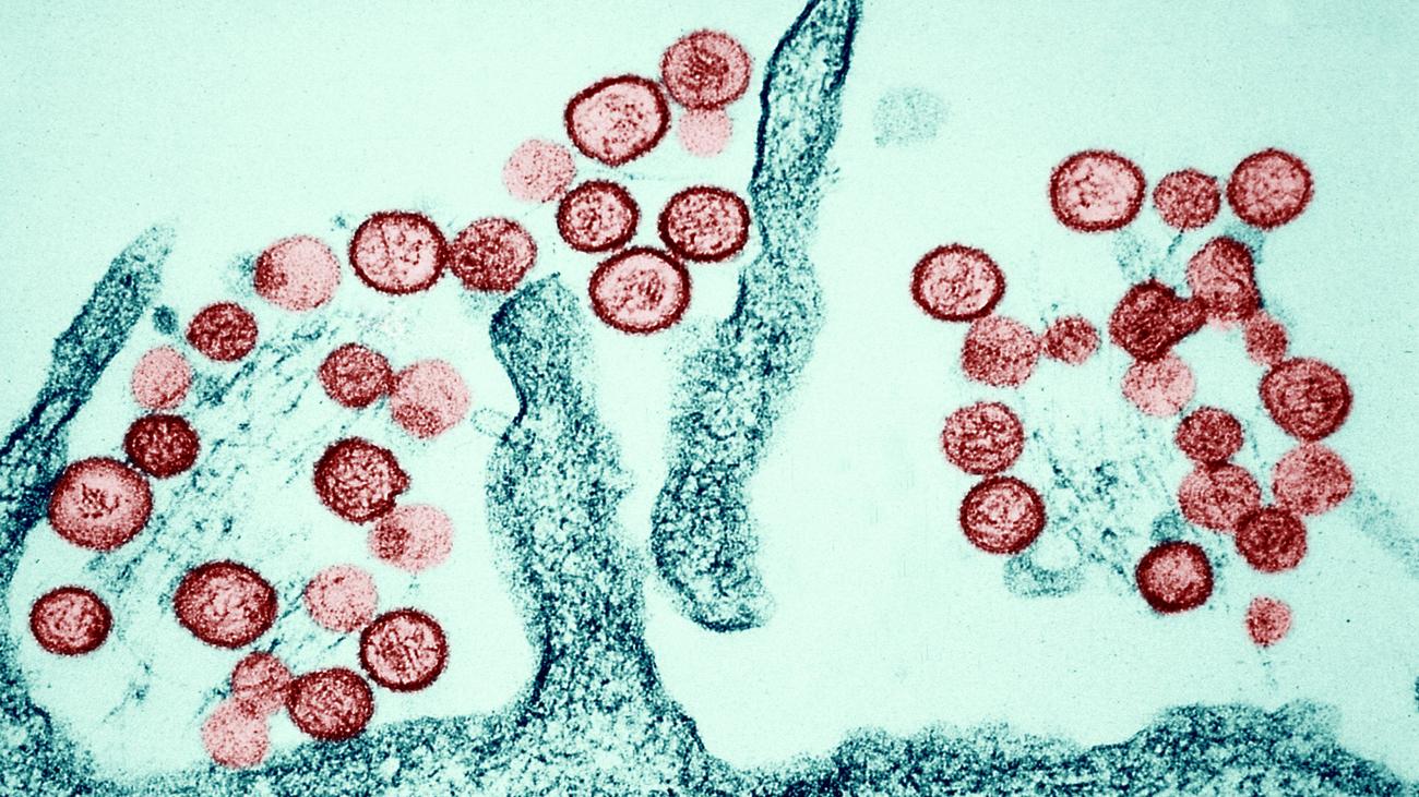 Hantavirus: Person in US-Bundesstaat Colorado stirbt nach Hantavirus-Infektion