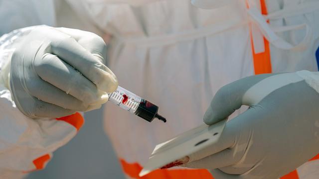 Ebola: Erster Ebola-Fall in Frankreich bei Kongo-Rückkehrer nachgewiesen