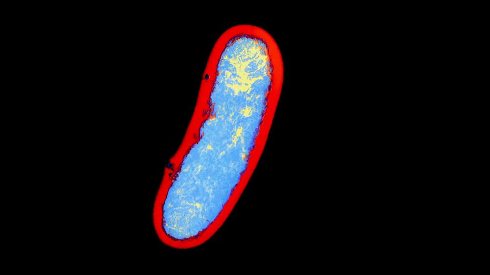 Todesfall in Forschungslabor: Das Bakterium Yersinia pestis in einer elektronenmikroskopischen Aufnahme.