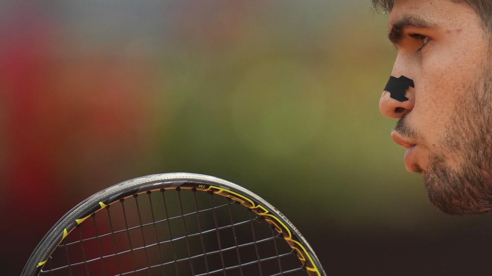 Nasenpflaster im Sport: Wenn's hilft: der Tennisprofi Carlos Alcaraz mit Nasenpflaster