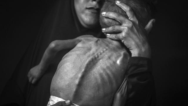 Hungersnot in Gaza: So sieht Hunger aus