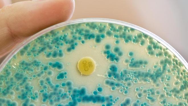 Erreger auch in Badeseen: Antibiotika-resistente Keime in Gewässern gefunden