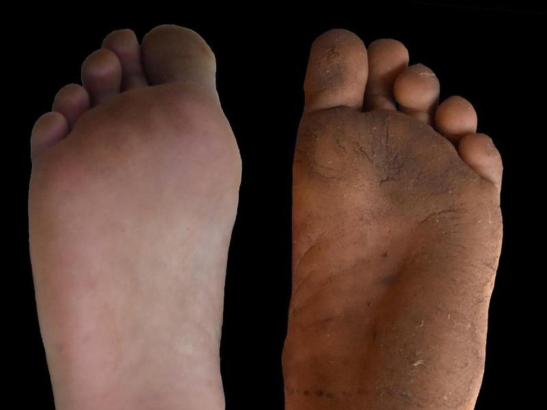 Barfußschuhe hornhaut Clearance