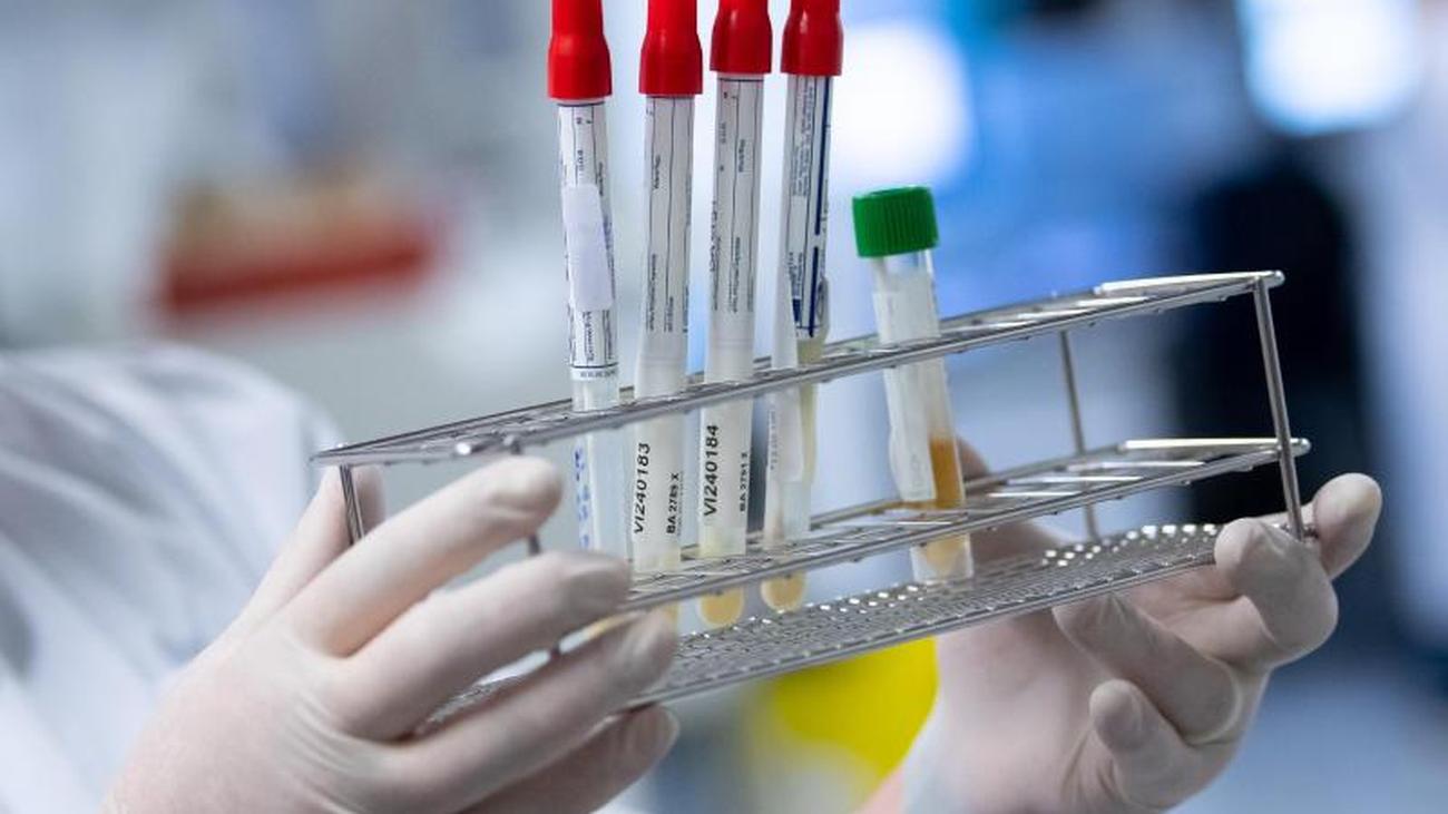 Kommunen: Kreis St. Wendel überschreitet kritische Infektions-Marke Kommunen: Kreis St. Wendel überschreitet kritische Infektions-Marke