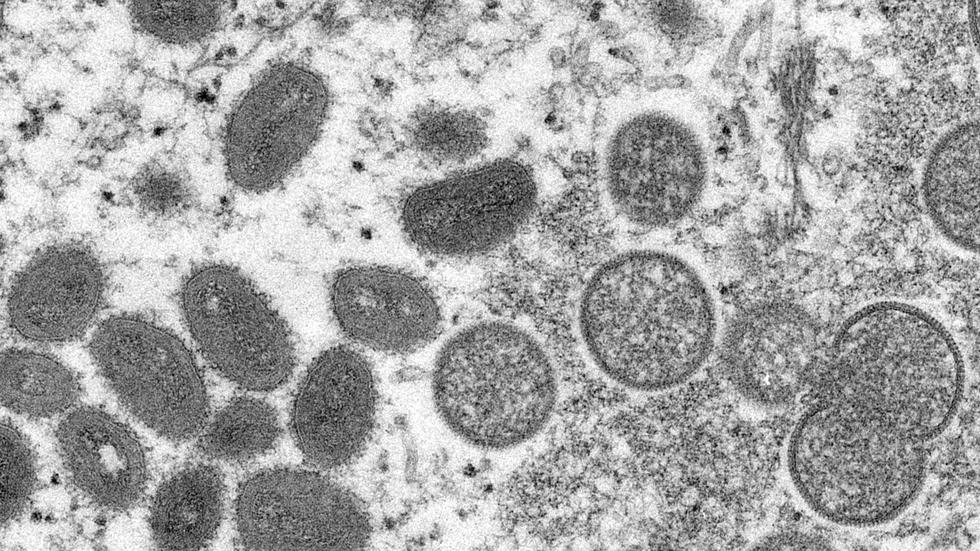 Affenpocken: Eine elektronenmikroskopische Aufnahme zeigt reife, ovale Affenpockenviren (l) und kugelförmige unreife Virionen (r).