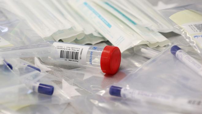 Corona-Pandemie: Die einzelnen Komponenten für den «Lolli-Test» liegen auf einem Schreibtisch.