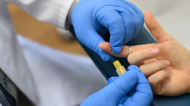 Gesundheit: RKI: Zahl der HIV-Neuinfektionen 2022 leicht gestiegen