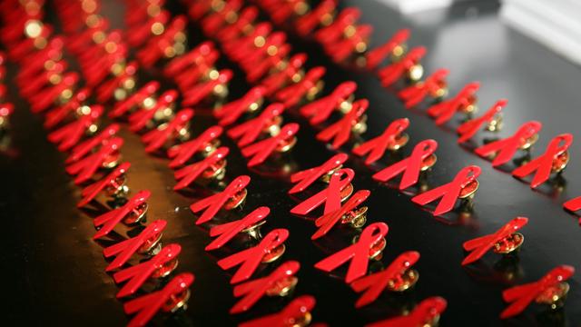 Statistik: 60 Menschen in NRW starben infolge einer HIV-Infektion 