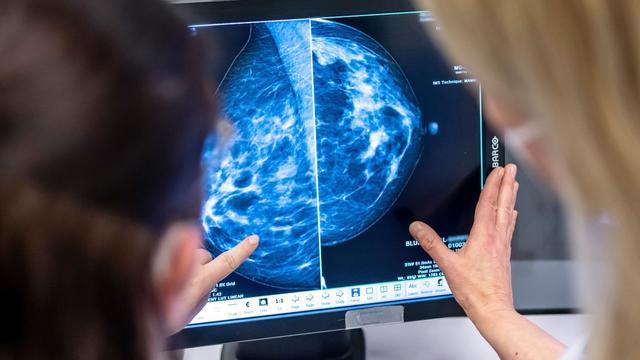Statistik: Etwas weniger Krebsneuerkrankungen 2022 in Thüringen