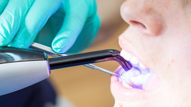 Gesundheit: Kassen-Zahnärzte kritisieren Amalgam-Verbot durch EU