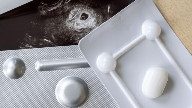 Schwangerschaftsabbrüche: Zahl der Abtreibungen in Brandenburg gestiegen