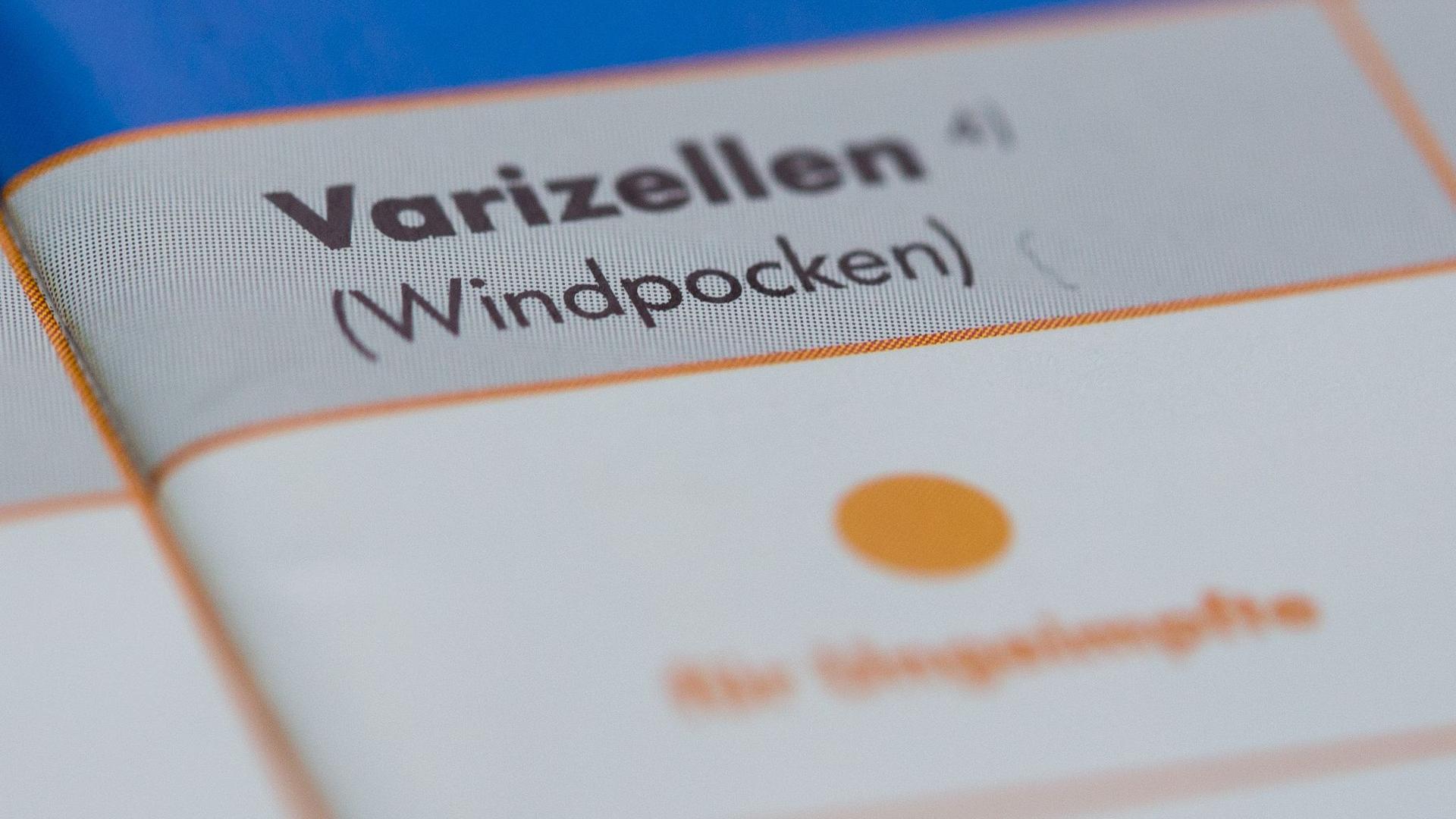 Krankheiten: Mehr als 20 Windpocken-Fälle an Hamburger Schule