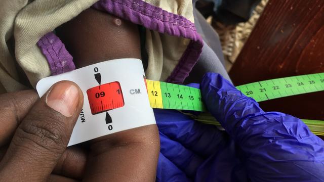 Kampf gegen den Hunger: Fortschritte gegen den Hunger - aber nicht überall