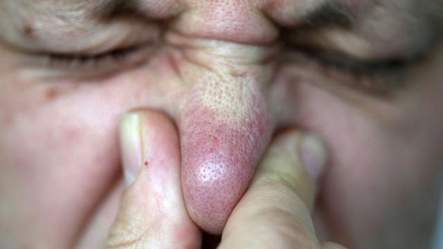 Verdauung im Flugzeug: Dicke Luft im Flieger: Das Pups-Problem