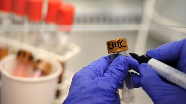 Ehec: Vier weitere Kinder in Mecklenburg-Vorpommern mit Ehec