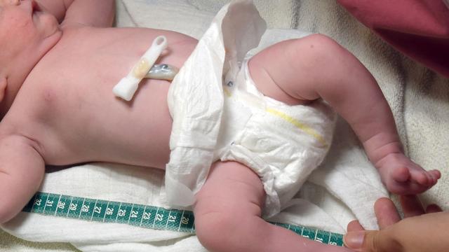 Geburtshilfe: Weniger Geld für Hebammen: Kreißsaalschließungen befürchtet